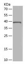    ACADM / Recombinant Human ACADM