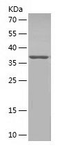    CPT1B / Recombinant Human CPT1B