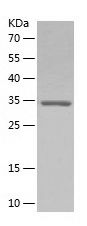    CHCHD2 / Recombinant Human CHCHD2