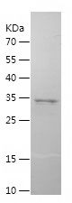 Recombinant Mouse CXCL5