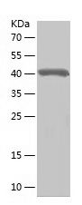    IFIT3 / Recombinant Human IFIT3