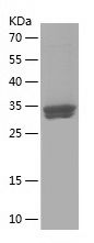    DDRGK1 / Recombinant Human DDRGK1