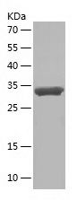    CISD1 / Recombinant Human CISD1