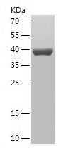    LMOD1 / Recombinant Human LMOD1