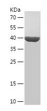    GPX7 / Recombinant Human GPX7