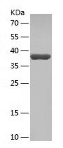    CCNE2 / Recombinant Human CCNE2