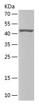    MTA3 / Recombinant Human MTA3