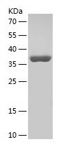    BBS4 / Recombinant Human BBS4