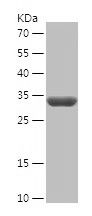    SDHB / Recombinant Human SDHB