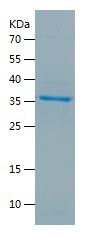    EIF2AK2 / Recombinant Human EIF2AK2