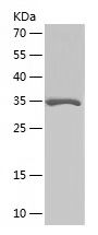    GABARAP / Recombinant Human GABARAP