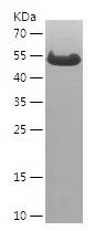    SYVN1 / Recombinant Human SYVN1