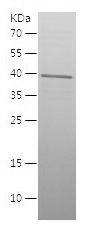    ACTN4 / Recombinant Human ACTN4