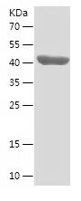    ACSL1 / Recombinant Human ACSL1