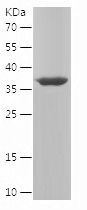    RNASEH1 / Recombinant Human RNASEH1