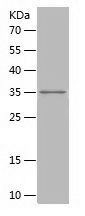    TET2 / Recombinant Human TET2