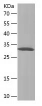    TIMP3 / Recombinant Human TIMP3