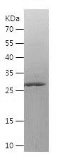    DYNLL1 / Recombinant Human DYNLL1