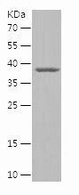    KAT5 / Recombinant Human KAT5