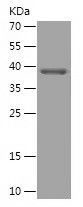    OTUD7B / Recombinant Human OTUD7B