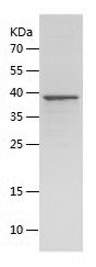    TOP2A / Recombinant Human TOP2A