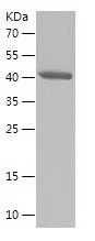    PTPN23 / Recombinant Human PTPN23