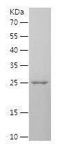    CEP63 / Recombinant Human CEP63