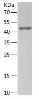    GP1BA / Recombinant Human GP1BA