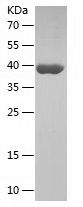    KMT5A / Recombinant Human KMT5A