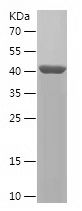    DIAPH3 / Recombinant Human DIAPH3