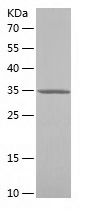    DRD2 / Recombinant Human DRD2