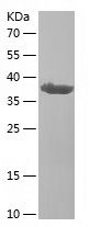    ARRB2 / Recombinant Human ARRB2