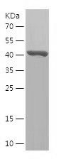    NSUN2 / Recombinant Human NSUN2