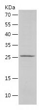    CTNI / Recombinant Human CTNI