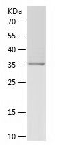    ITGB2 / Recombinant Human ITGB2