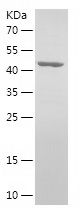    FBXO22 / Recombinant Human FBXO22