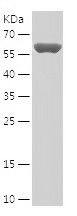    DHODH / Recombinant Human DHODH