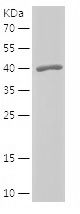    PSMD4 / Recombinant Human PSMD4