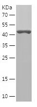    ALDH3A1 / Recombinant Human ALDH3A1