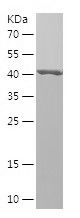    CCDC22 / Recombinant Human CCDC22