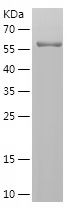    CLTA / Recombinant Human CLTA