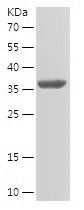    RPL23 / Recombinant Human RPL23