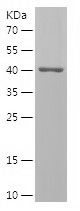    HADH / Recombinant Human HADH