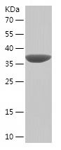    BCAP31 / Recombinant Human BCAP31