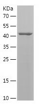    VPS33B / Recombinant Human VPS33B