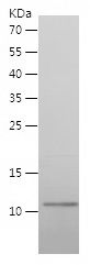    DYNLL1 / Recombinant Human DYNLL1