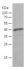    ANGPT2 / Recombinant Human ANGPT2