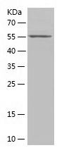    ANKRD1 / Recombinant Human ANKRD1