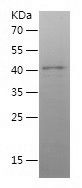    SECISBP2 / Recombinant Human SECISBP2