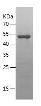    CHMP2B / Recombinant Human CHMP2B